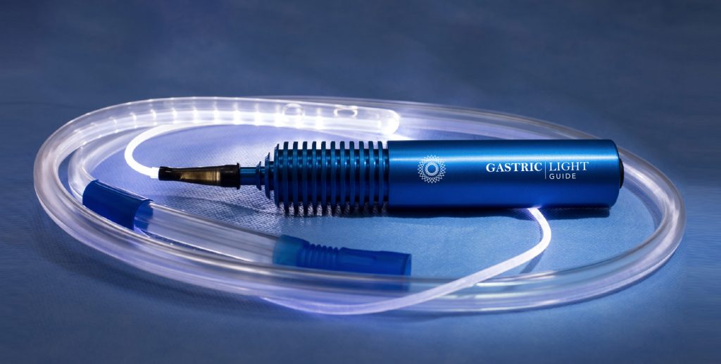 a blue handle with gastric light guide logo on and ribbed grips, an illuminated light fiber in a long clear round ended tube, and a short clear tube with a blue opening at one end